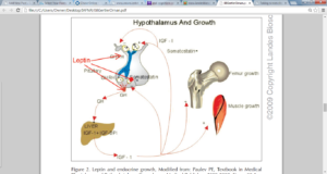 Neurohormonal Scoliosis