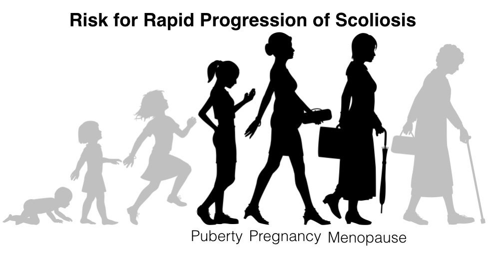 Puberty-Pregnancy-and-Menopause-2 - Scoli-Fit  Non-surgical Scoliosis  Treatment by Board-Certified Doctors