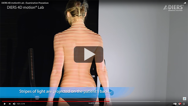 Scoliosis care with fewer X-Rays using Rasterstereography click here to learn more